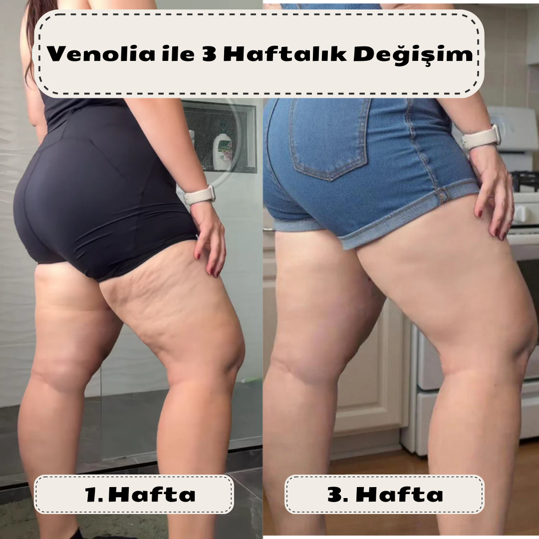 Vernolia Anti-Selülit Masaj Yağı – Kolajen & Kök Hücre Destekli
