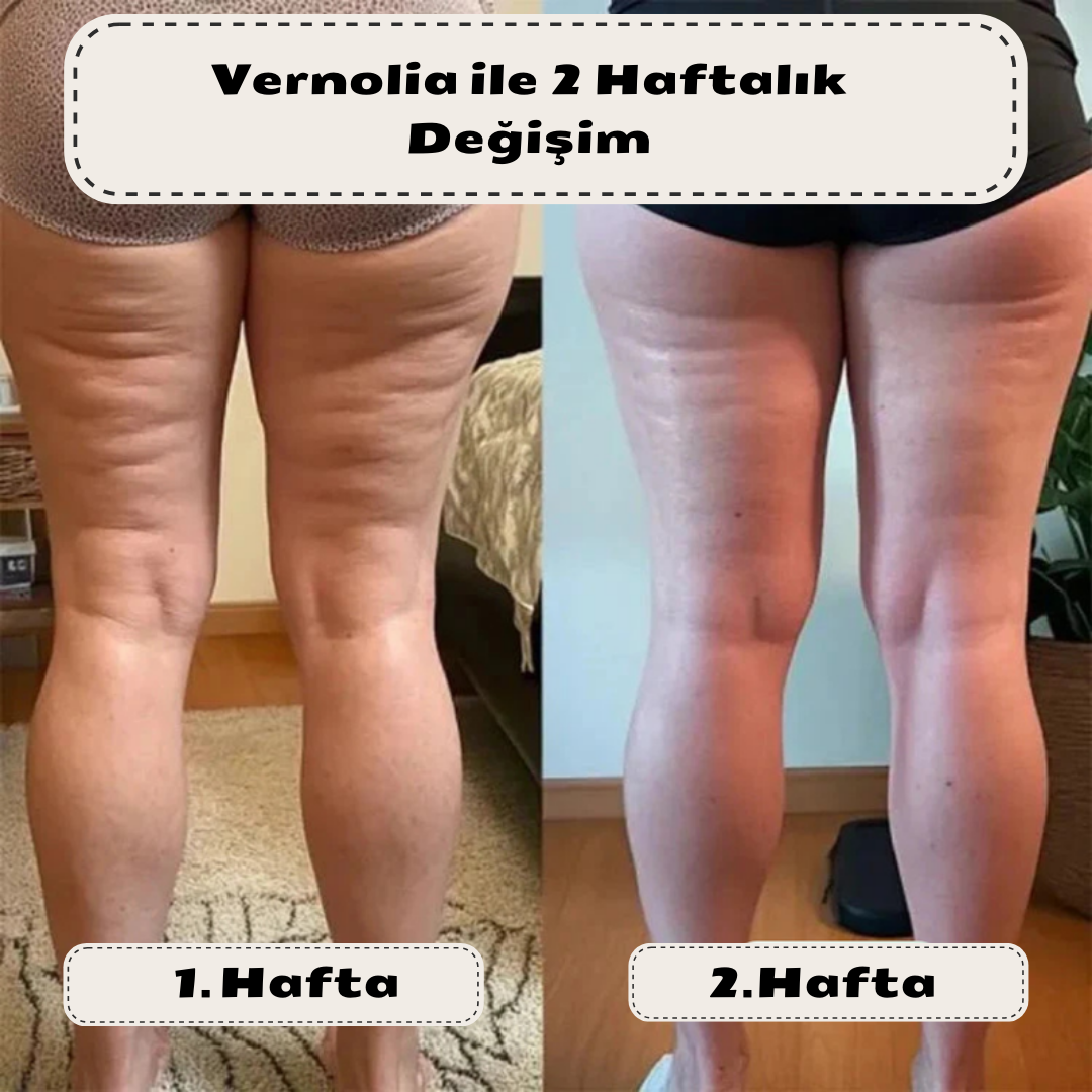 Vernolia Anti-Selülit Masaj Yağı – Kolajen & Kök Hücre Destekli