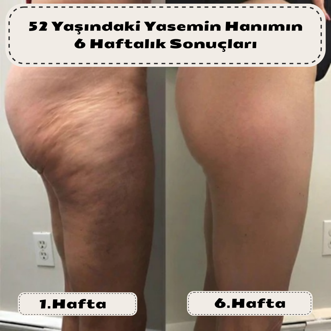 Vernolia Anti-Selülit Masaj Yağı – Kolajen & Kök Hücre Destekli