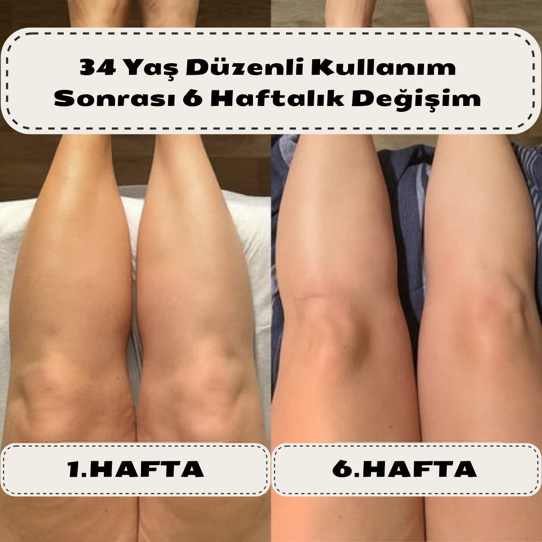 Vernolia Anti-Selülit Masaj Yağı – Kolajen & Kök Hücre Destekli